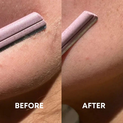 Dermaplaning Set